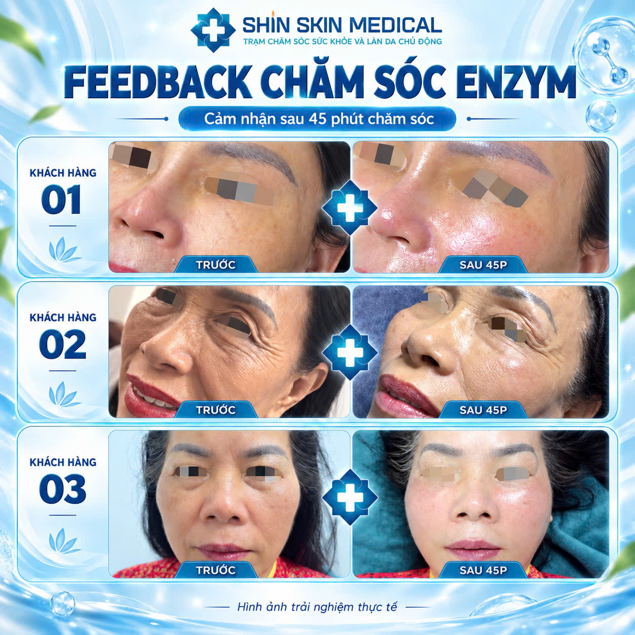 Chăm Mầm Enzym 4